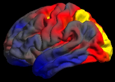 Image of a brain